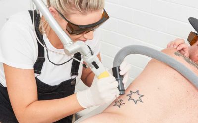 10 Ways To Accelerate Your Tattoo Removal Journey